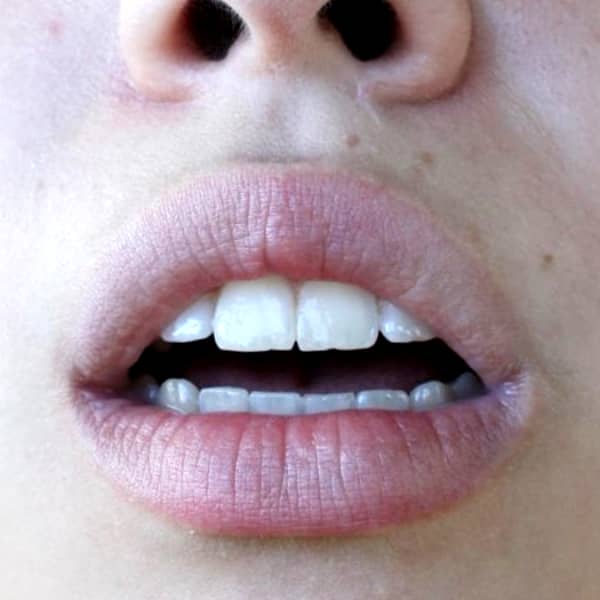 【顔】艶っぽい唇や綺麗な歯を楽しむ女性の口の接写画像